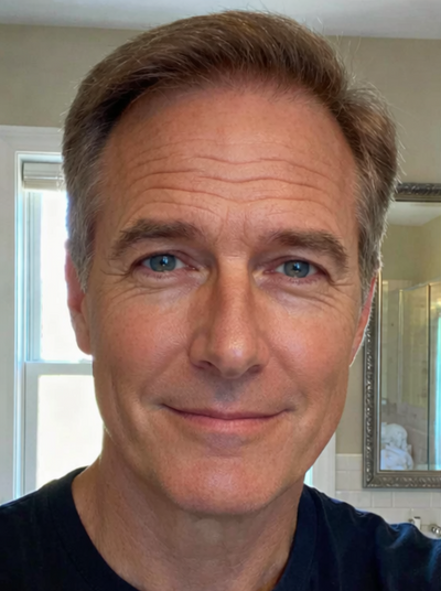 Before - James T.