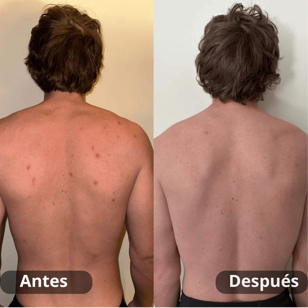 <p><strong>Resultados reales. Sin filtros.</strong></p>