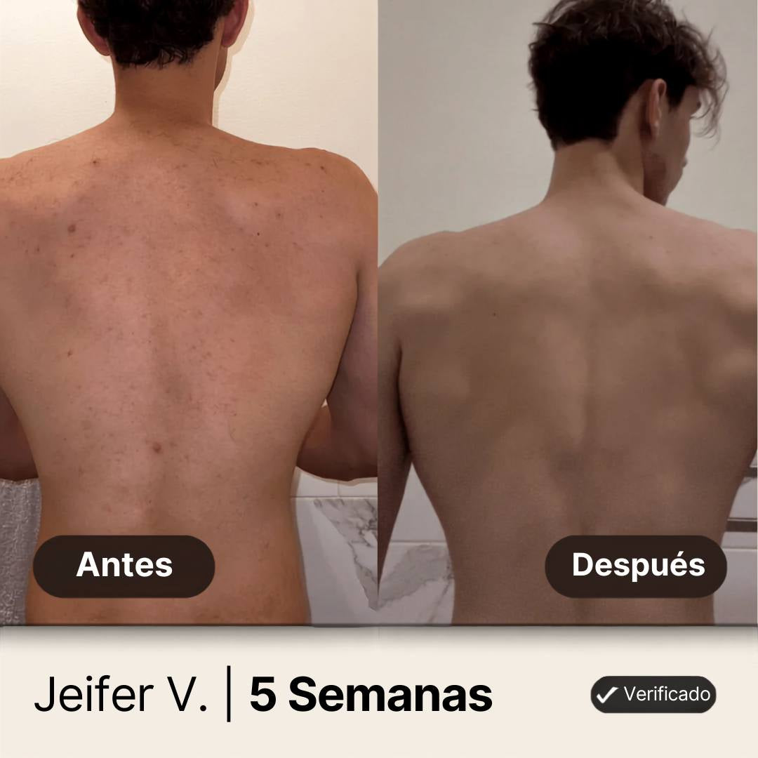 Gel de ducha Nandora body para el acné