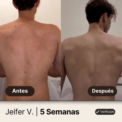 Gel de ducha Nandora body para el acné