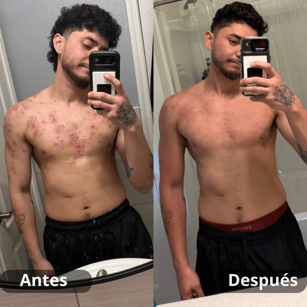 <p><strong>Resultados reales. Sin filtros.</strong></p>