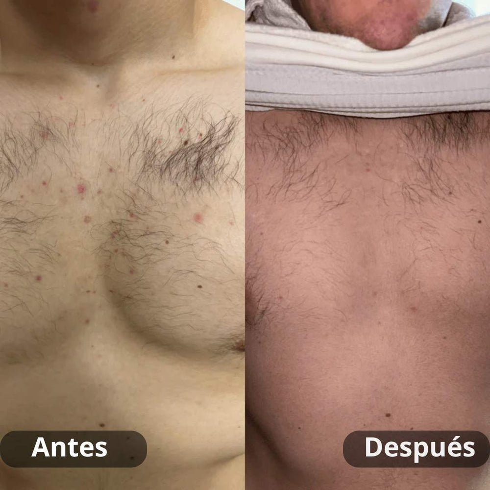 <p><strong>Resultados reales. Sin filtros.</strong></p>