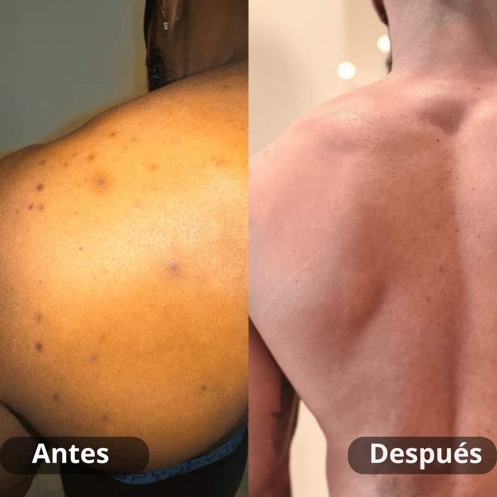 <p><strong>Resultados reales. Sin filtros.</strong></p>