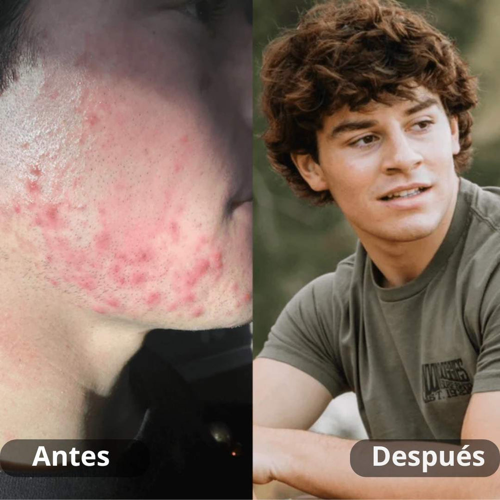<p><strong>Resultados reales. Sin filtros.</strong></p>