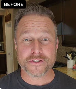 Before - Mike R.