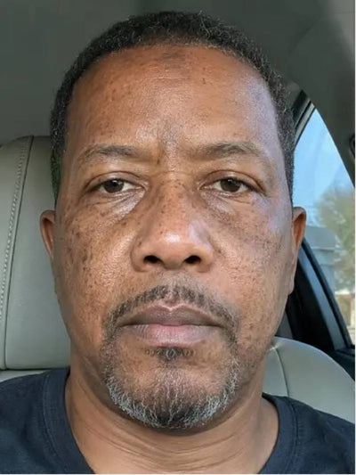 Before - Mike R.