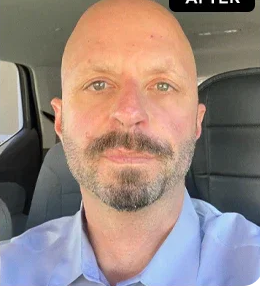 After - David C.